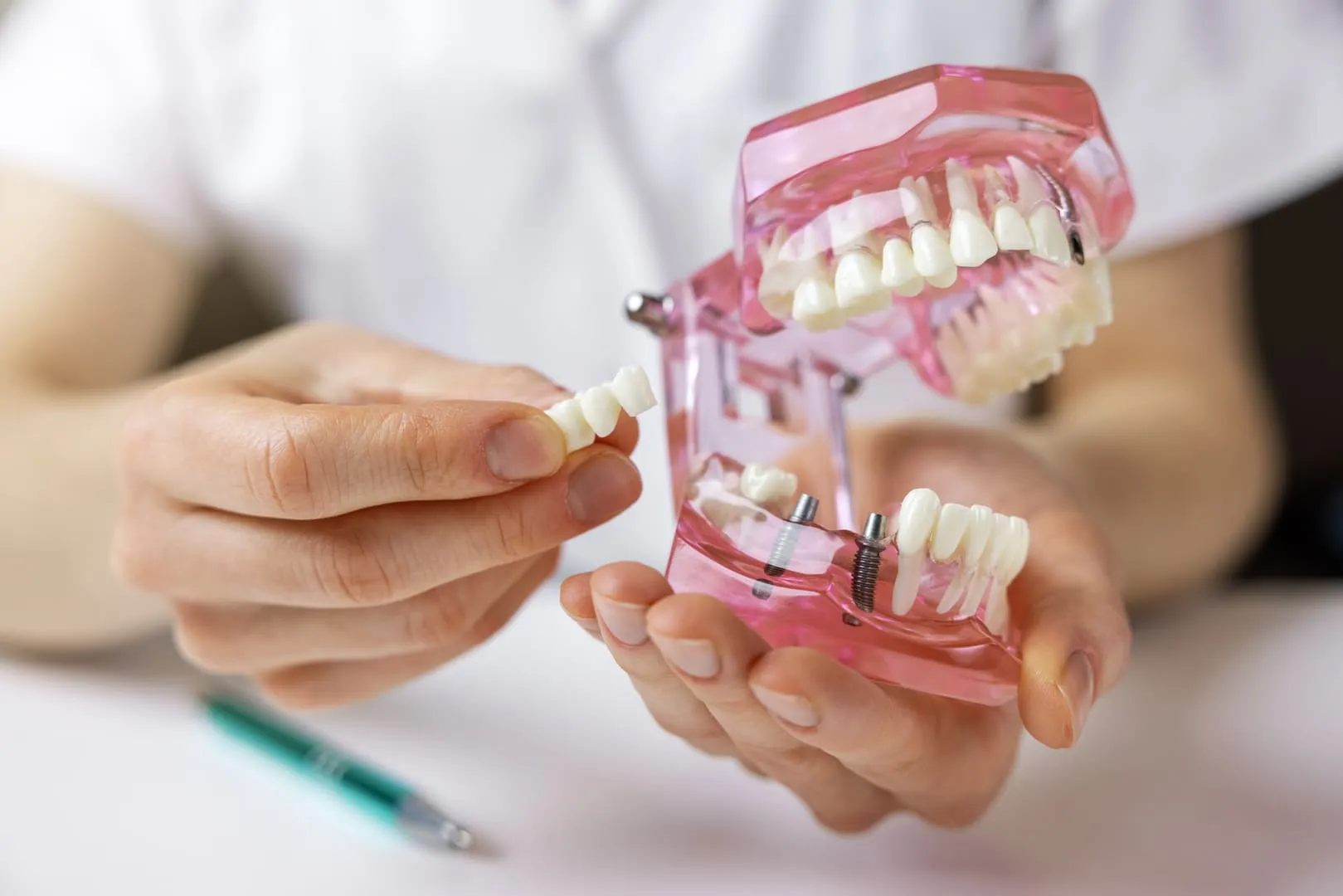 Restore Your Smile with Dental Bridges in Fort Collins