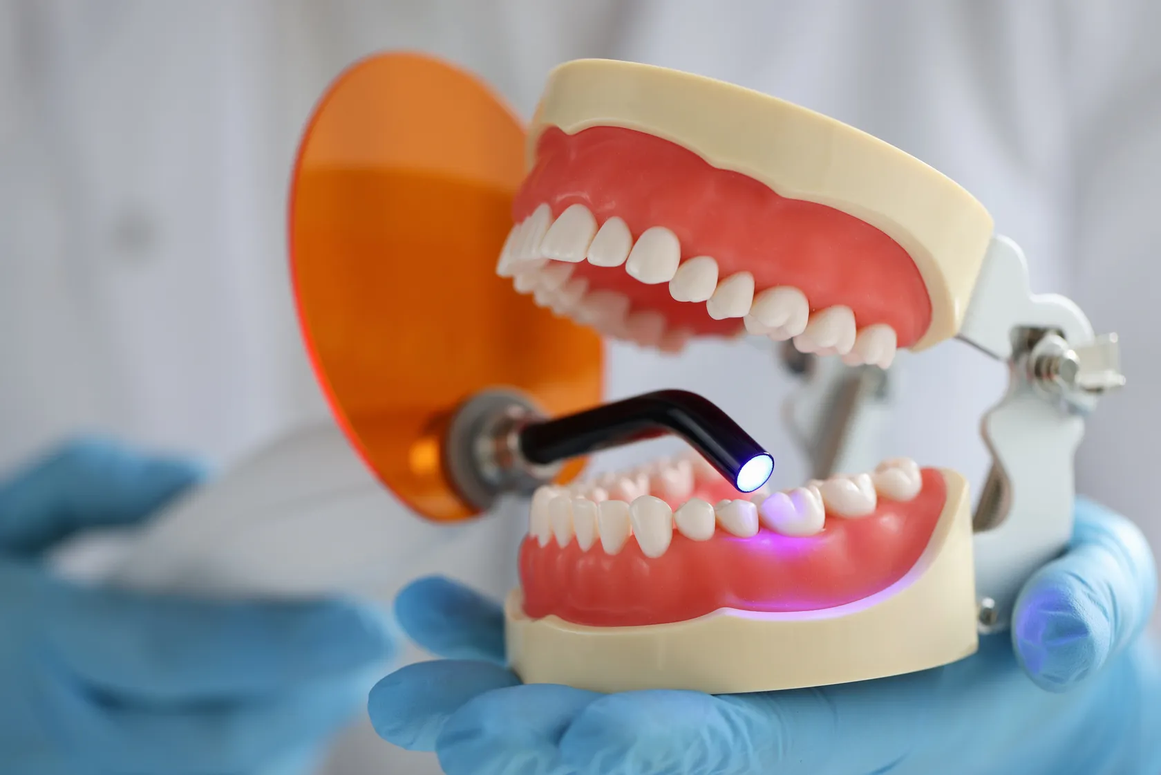 Full and Partial Dentures