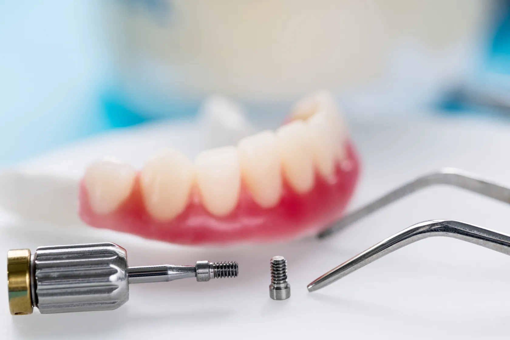 Elevate Your Smile with Implant Supported Dentures