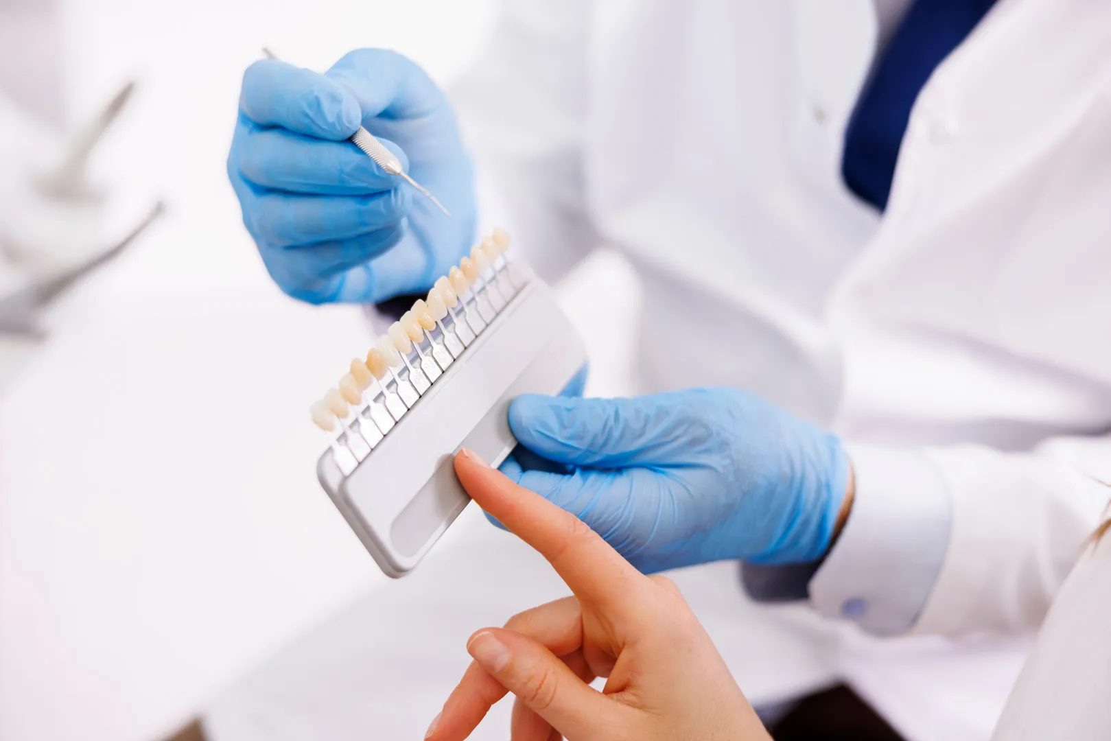 Transform Your Smile with Veneers in Fort Collins