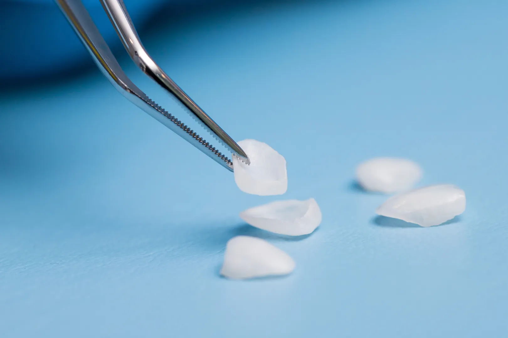 Discover the Beauty of Dental Veneers