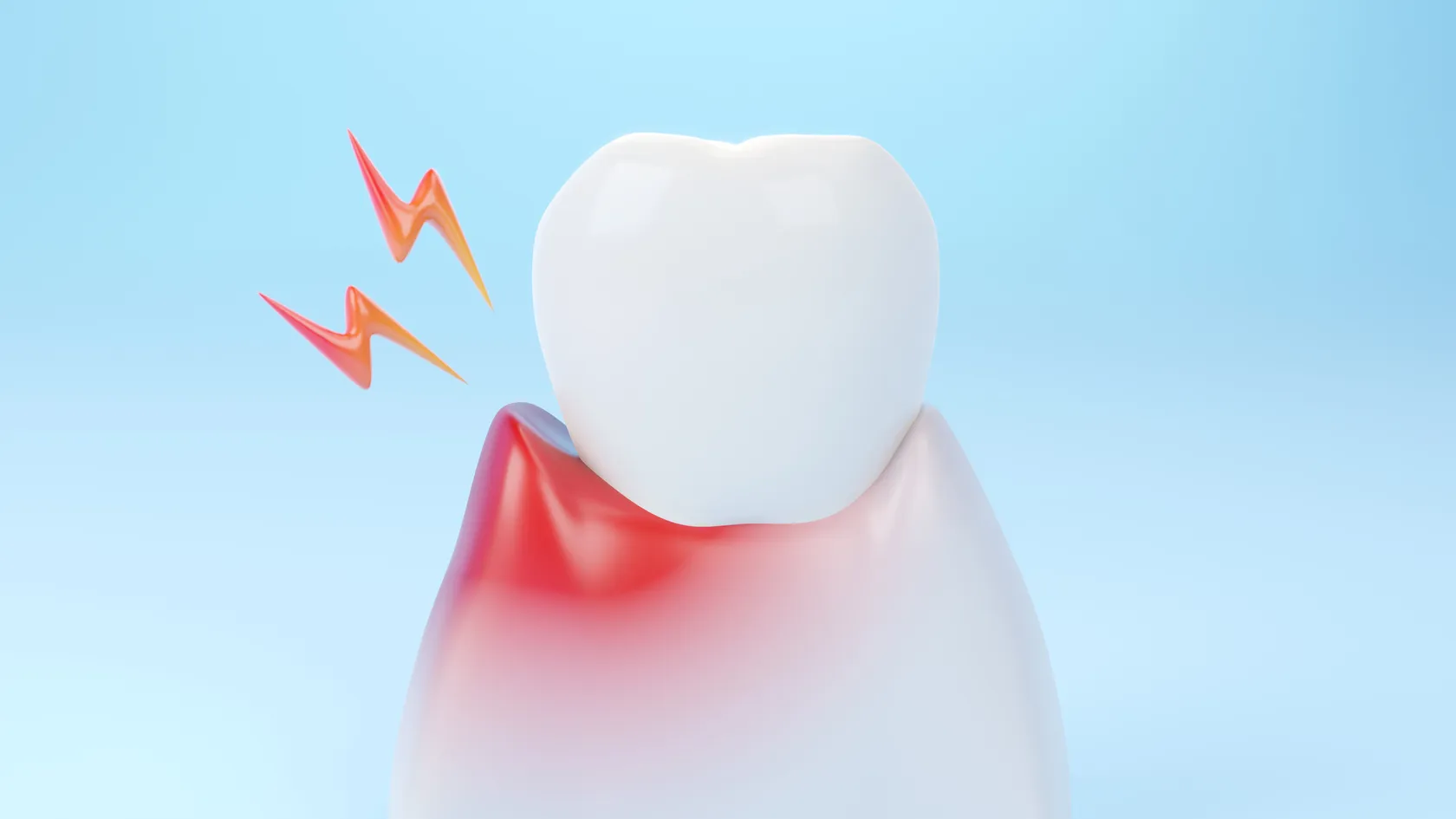 Understanding Periodontal Disease