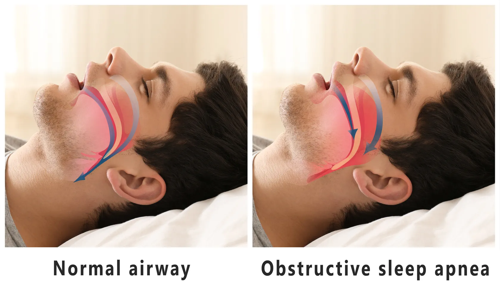 Discover Sleep Apnea Solutions